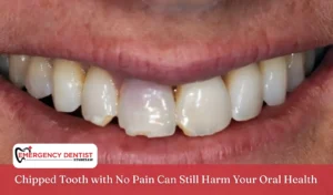Chipped Tooth with No Pain Can Still Harm Your Oral Health