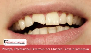 Prompt, Professional Treatment for Chipped Tooth in Kennesaw