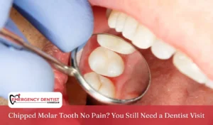 Chipped Molar Tooth No Pain You Still Need a Dentist Visit