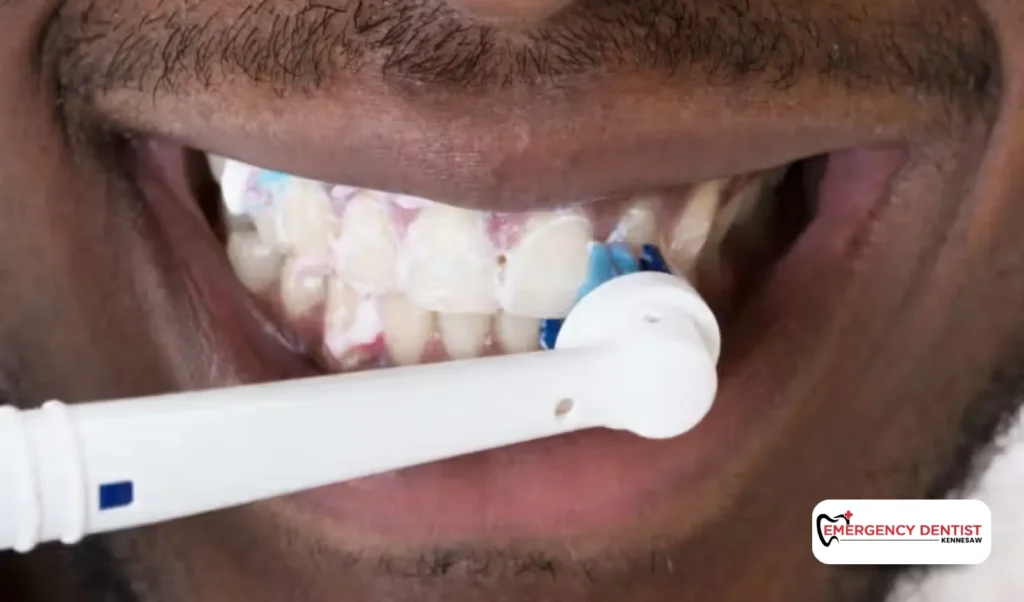 Tips for Managing Pain After a Root Canal