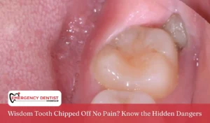 Wisdom Tooth Chipped Off No Pain Know the Hidden Dangers