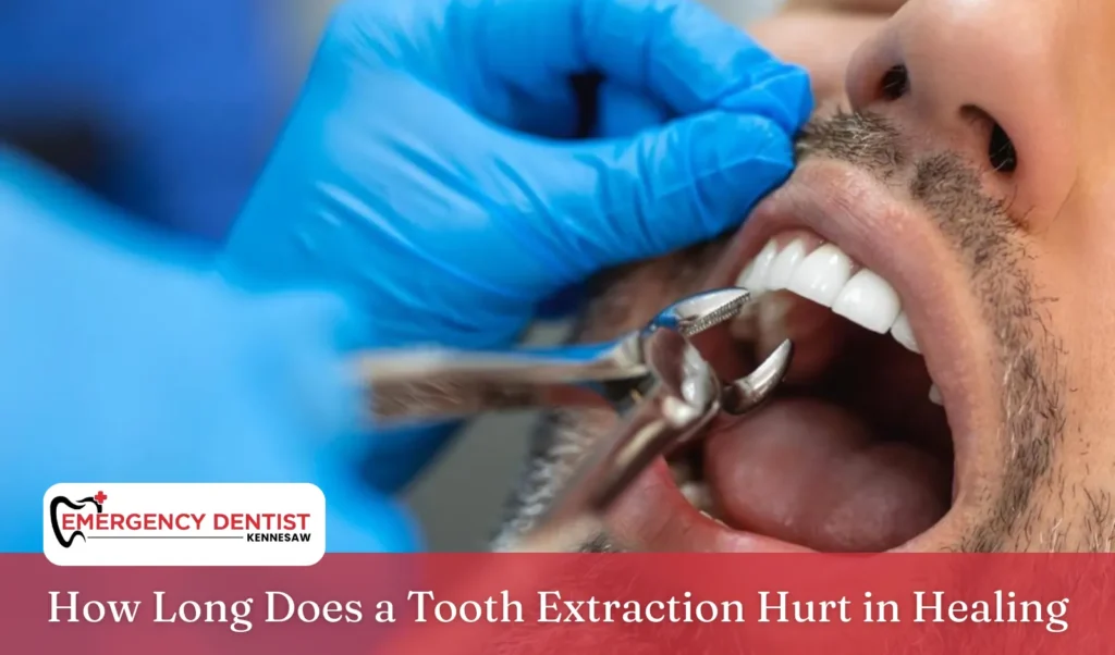 How Long Does a Tooth Extraction Hurt in Healing
