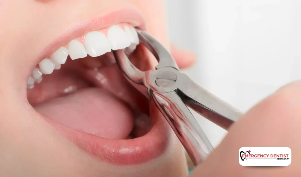 Severe Pain or Bleeding After Extraction_ What to Do Next