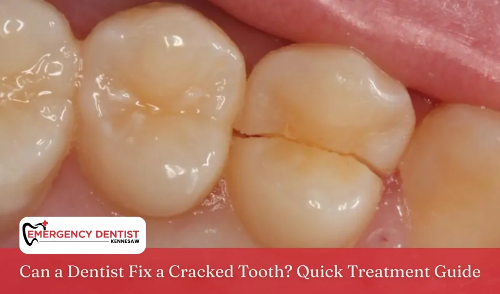 Can a Dentist Fix a Cracked Tooth Quick Treatment Guide