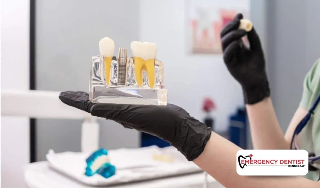 Choosing the Right Dental Office for Implants