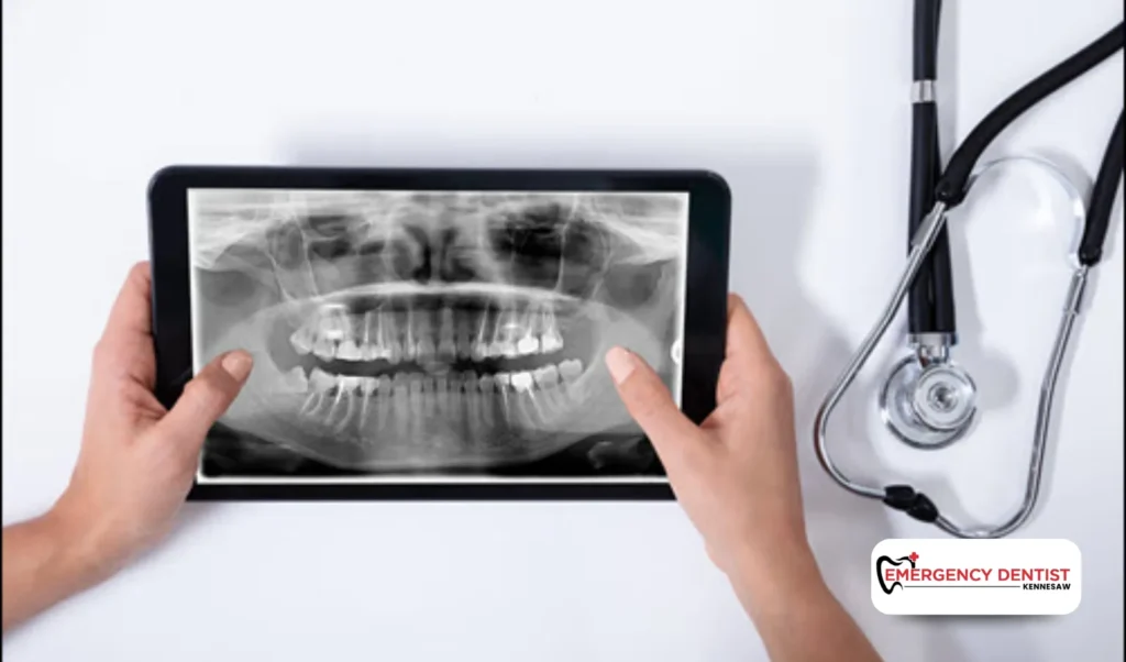 How Dentists Fix Cracked Teeth