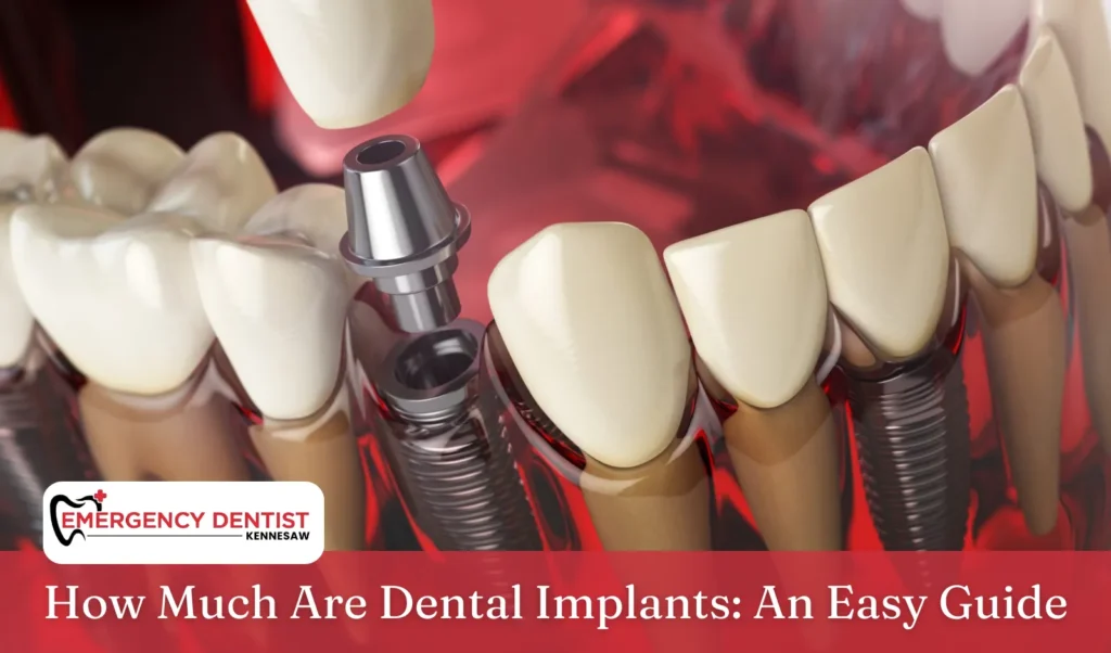 How Much Are Dental Implants: An Easy Guide