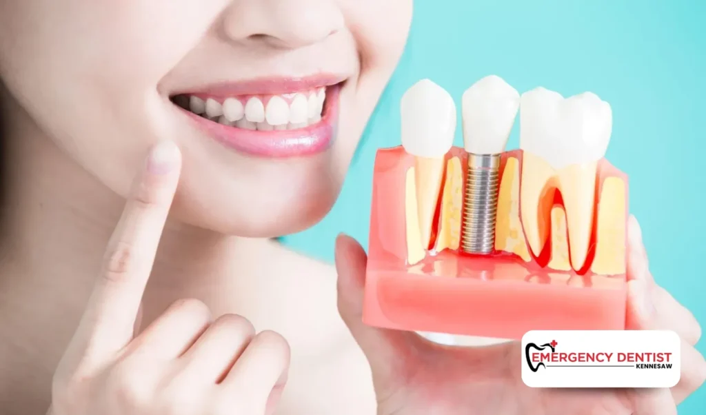 Caring for Your Dental Implants