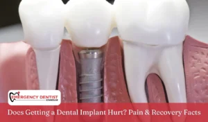 Does Getting a Dental Implant Hurt Pain & Recovery Facts