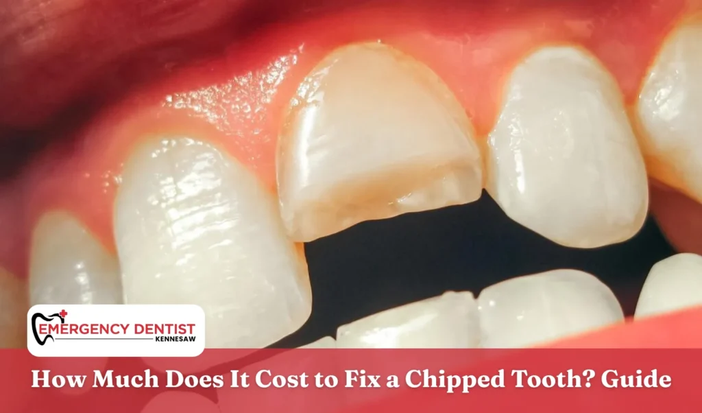 How Much Does It Cost to Fix a Chipped Tooth Guide