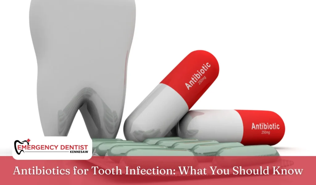 Antibiotics for Tooth Infection What You Should Know
