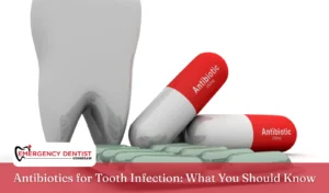 Antibiotics for Tooth Infection What You Should Know