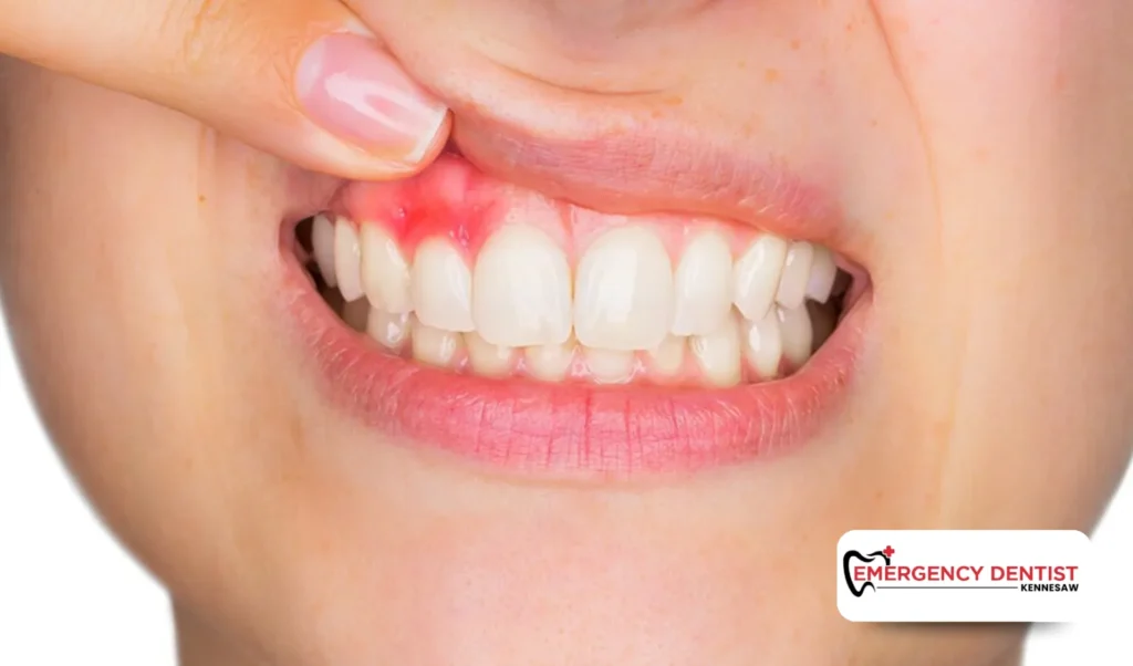 Common Symptoms to Watch For