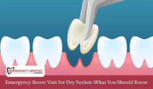 Emergency Room Visit for Dry Socket What You Should Know
