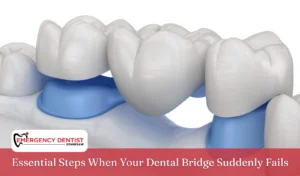 Essential Steps When Your Dental Bridge Suddenly Fails