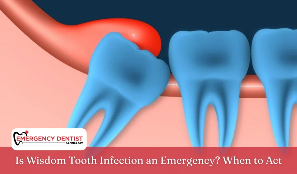 Is Wisdom Tooth Infection an Emergency? When to Act