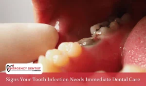 Signs Your Tooth Infection Needs Immediate Dental Care