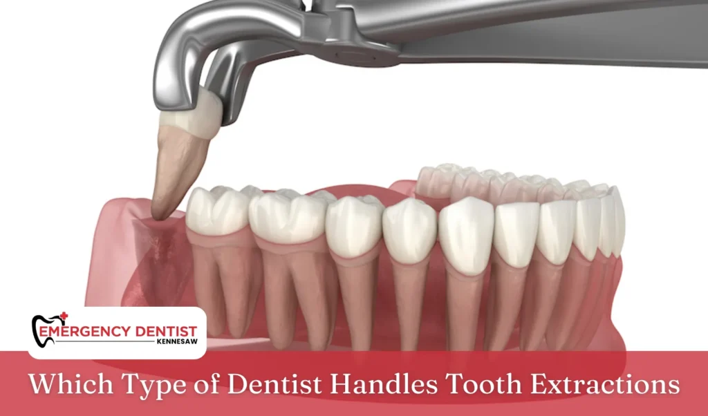 Which Type of Dentist Handles Tooth Extractions