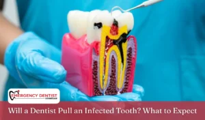 Will a Dentist Pull an Infected Tooth What to Expect