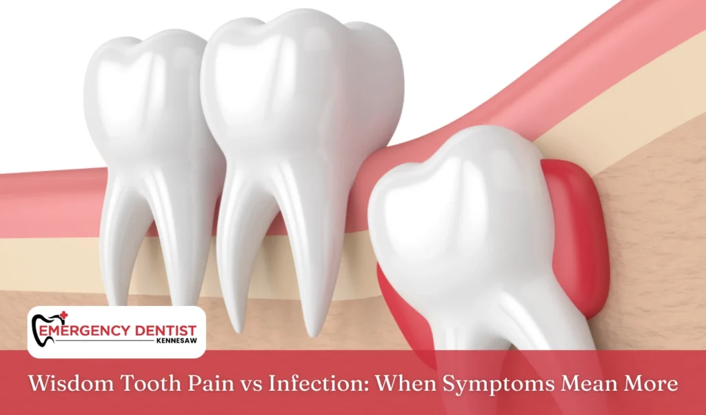 Wisdom Tooth Pain vs Infection When Symptoms Mean More