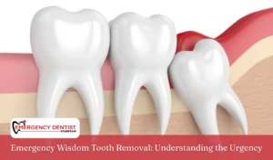 Emergency Wisdom Tooth Removal Understanding the Urgency