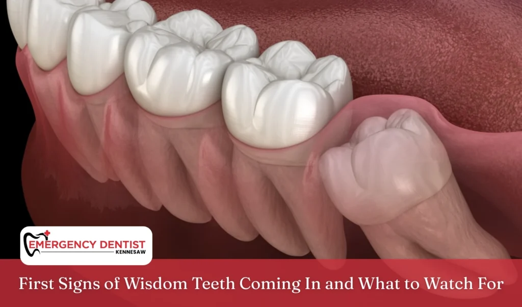 First Signs of Wisdom Teeth Coming In and What to Watch For