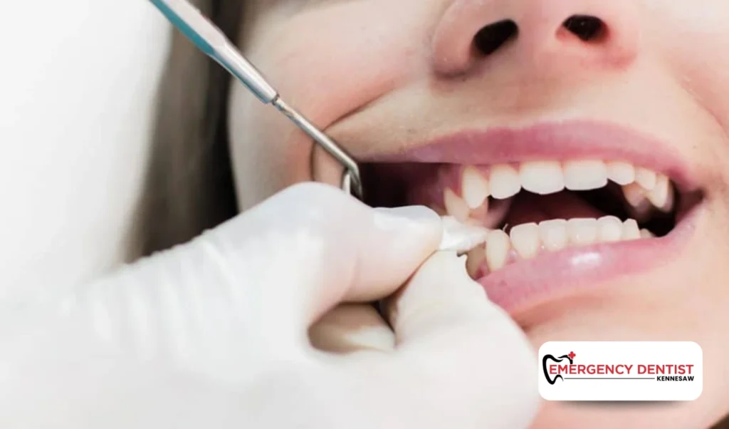 Dos and Don'ts After Wisdom Tooth Extraction