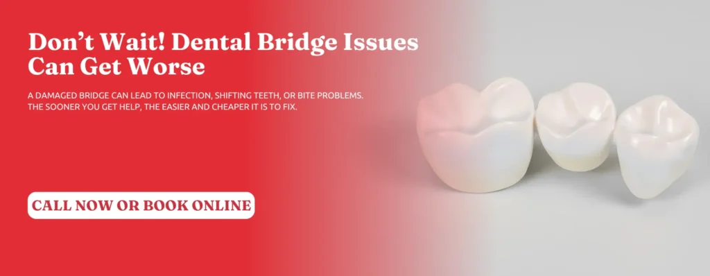 Dental-Bridge-Repair-in-Kennesaw-GA