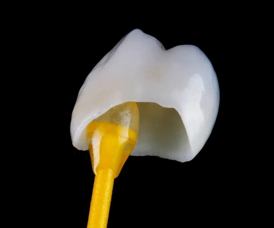 Dental-Crowns-Kennesaw-GA