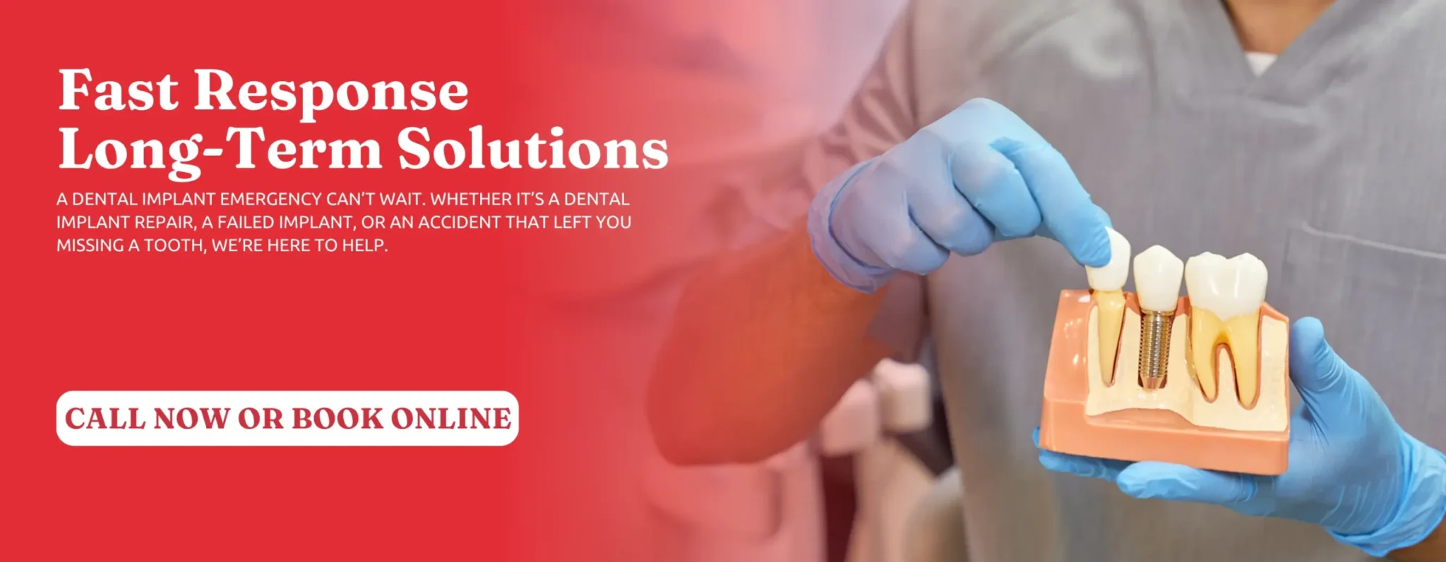 Dental-Implant-Solutions-in-Kennesaw-GA