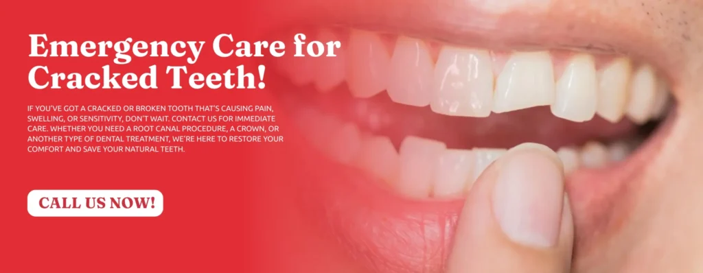 Emergency-Cracked-Tooth-Repair-in-Kennesaw-GA