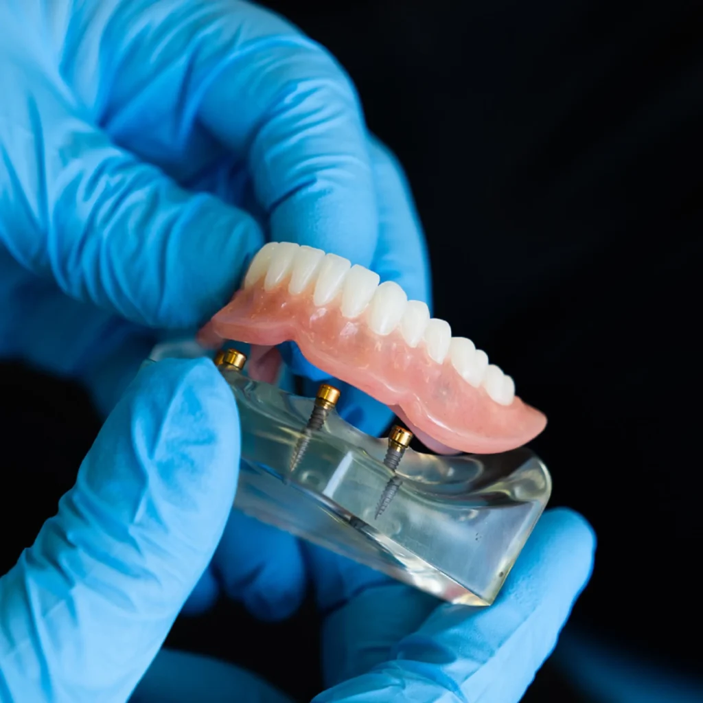 Emergency-Denture-Repairs-in-Kennesaw-GA