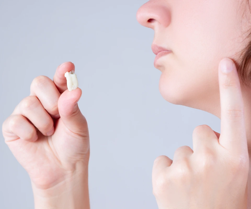 Emergency-Wisdom-Tooth-Extraction-Kennesaw-GA