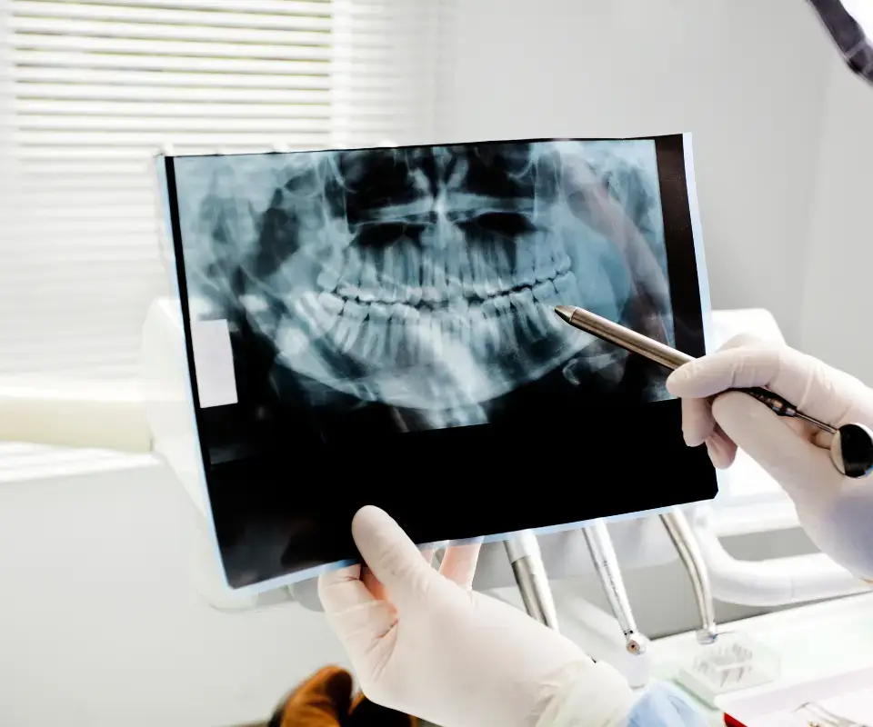 Emergency-dental-X-rays-Kennesaw-GA