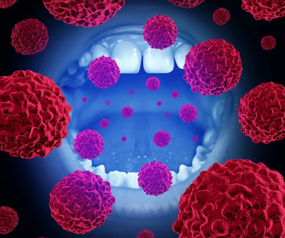 Oral-Cancer-Kennesaw-GA