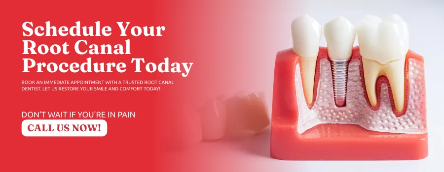 Schedule-Root-Canal-Procedure-in-Kennesaw-GA