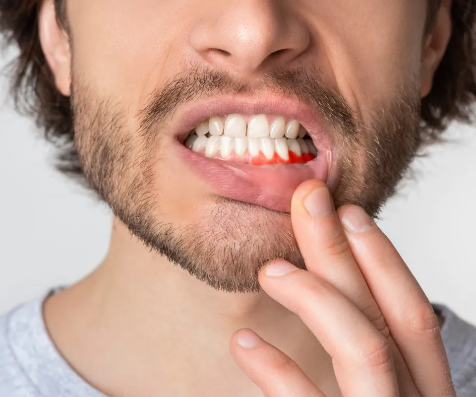 When-to-See-an-Emergency-Dentist-for-a-Tooth-Infection-Kennesaw-GA
