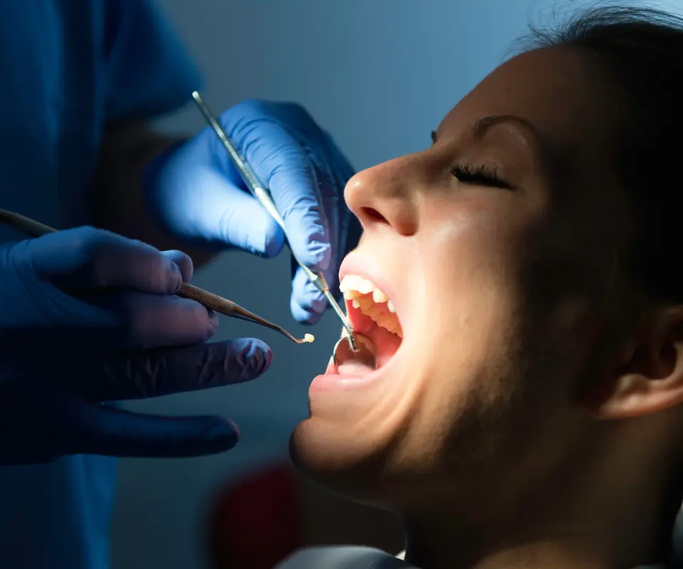 Lost-Fillings-or-Crowns-Kennesaw-GA