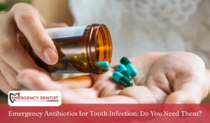 emergency-antibiotics-tooth-infection