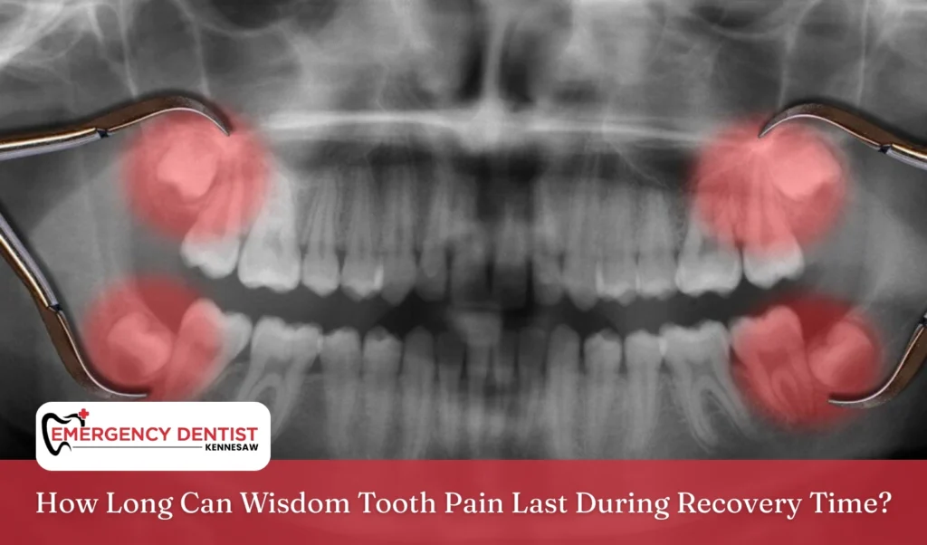 wisdom-tooth-pain-recovery-time