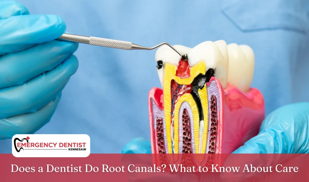 does-a-dentist-do-root-canals