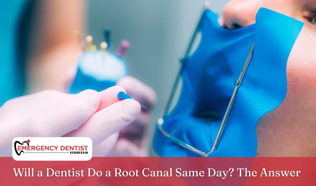 will-a-dentist-do-a-root-canal-same-day