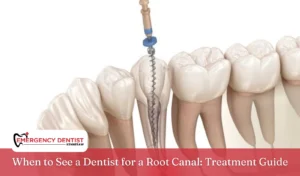 When to See a Dentist for a Root Canal Treatment Guide